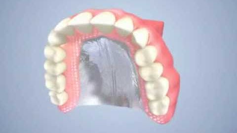 Prothèse dentaire complète amovible (dentier) - Centres dentaires Lapointe