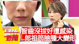 智齒沒拔好遭感染！郎祖筠臉腫大變形？！【#醫師好辣】20201124 part2 EP1055 洪永祥 陳保仁