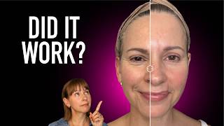 I Used This Laser Device for 8 Weeks… Here's What Happened