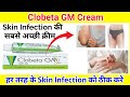 Clobeta gm Cream ll Skin Infection की सबसे अच्छी क्रीम ll Pharma lectures ll