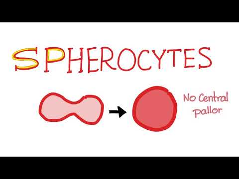 Video: Spherocytes zinaonyesha nini?