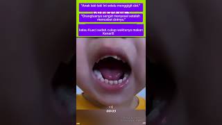 Dotnya Nggak Lepas Giginya Ikutan Bentuk Dot gigi anak dot