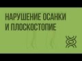 Нарушение осанки и плоскостопие. Видеоурок по биологии 8 класс