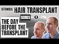 The Day Before My Hair Transplant in Istanbul (Procedure Preparation)