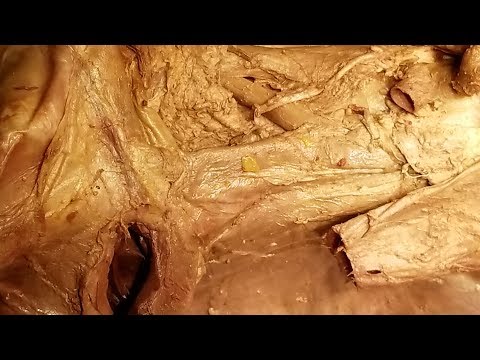 Video: Verschil Tussen Aorta En Vena Cava