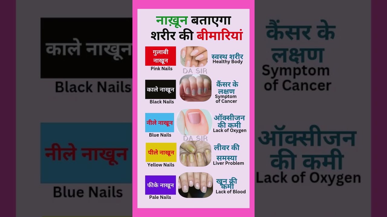 Nails Show The Diseases Of Body Disease Nail Mandible Shortsfeed Dasir4u