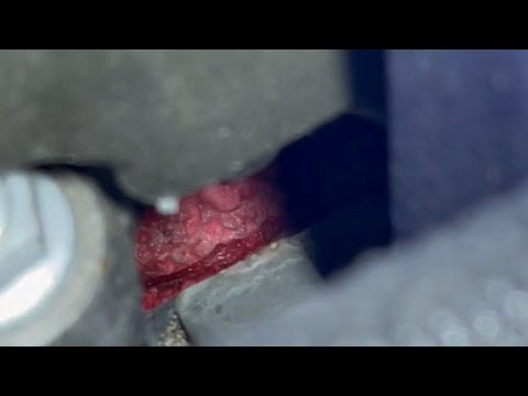 RCF Valley Plate Leak - YouTube