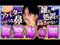修正のプロに聞く鼻美容整形の闇