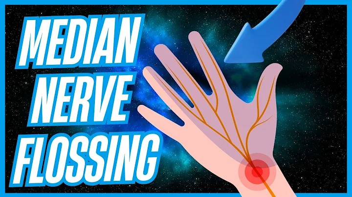 Median Nerve Flossing or Gliding for Carpal Tunnel Syndrome