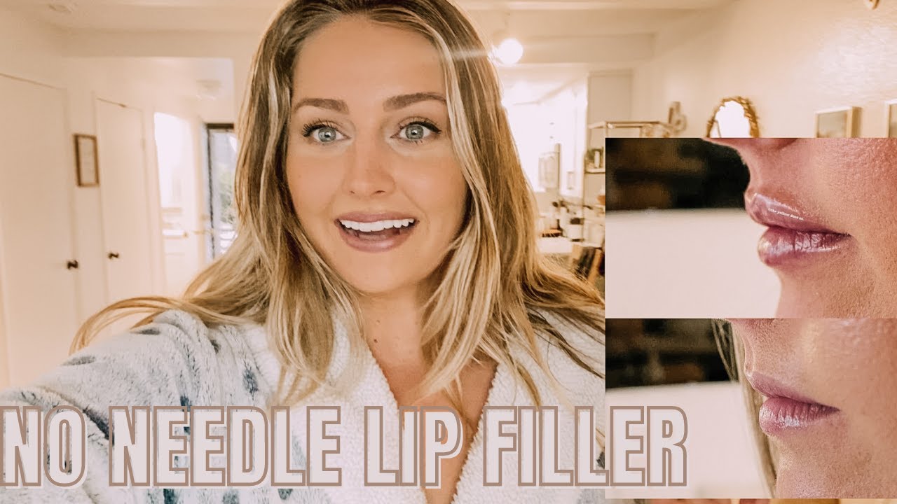 NO NEEDLE LIP FILLER before + after YouTube