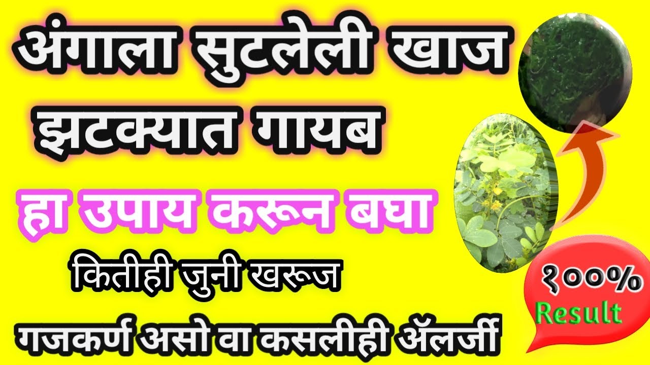 अंगाला सुटलेली खाज झटक्यात गायब होईल, Angala Khaj Yene Upay, Itching