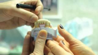 Протезирование зубов в стоматологиях Полимедикор(, 2016-05-05T13:39:41.000Z)