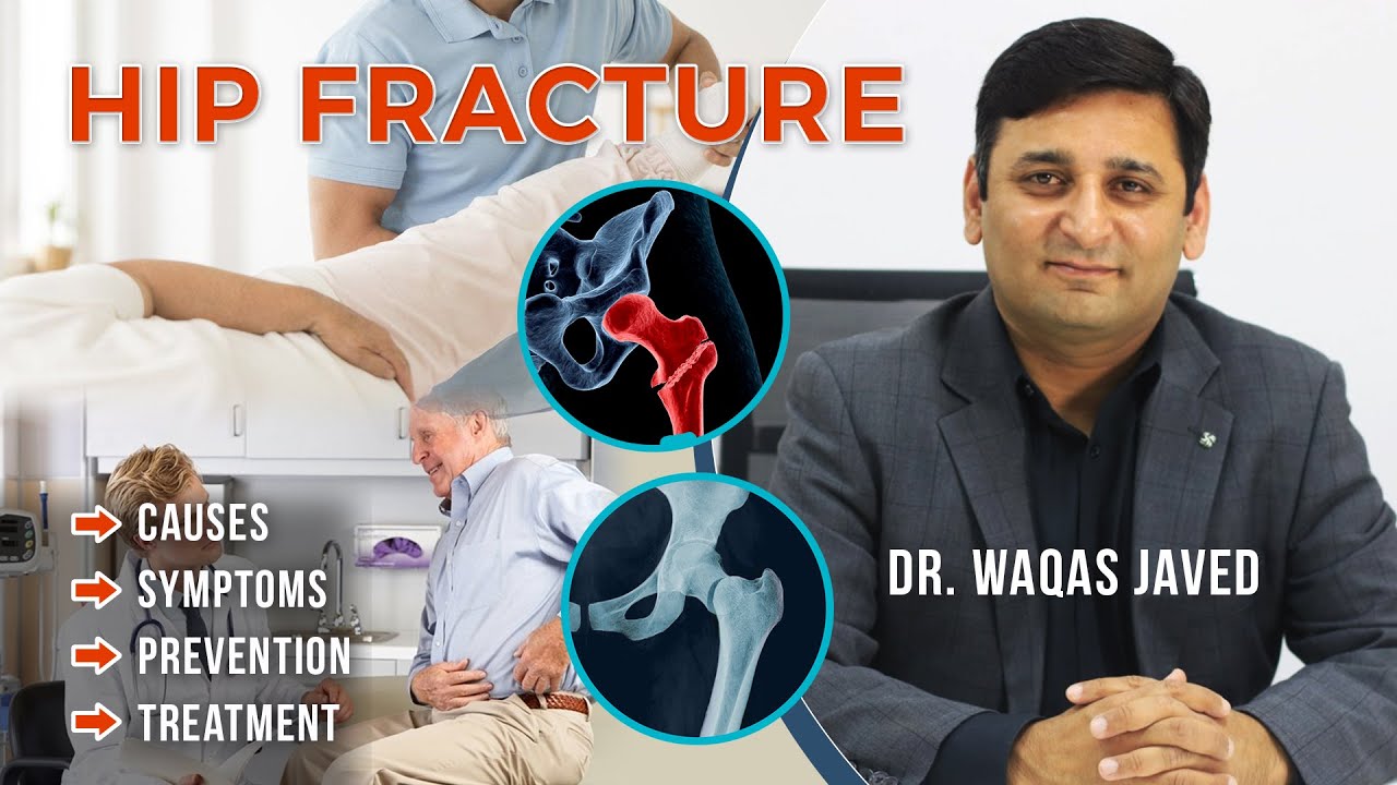 Dr. Waqas Javed | Hip Fracture | Symptoms, Causes, Treatment