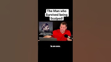 The man who survived being Scalped by Indians. #shorts