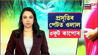 LIVE : চৰকাৰী চিকিৎসালয়ৰ দায়িত্বজ্ঞানহীনতা, প্ৰসূতিৰ পেটত ওলাল ৩ফুট কাপোৰ N18L