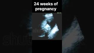 24 WEEKS OF PREGNANCY #shortsfeed #baby #fetus #ultrasound #mother #motherhood #pregnancy #shorts