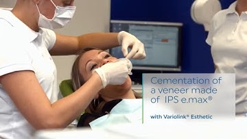 Variolink® Esthetic LC - Cementation of a veneer made of IPS e.max® | EN | Ivoclar