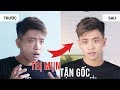 3 Nguyên Tắc Cần Nhớ Nếu Muốn Trị Mụn Tận Gốc Thành Công | 30Shine Bí Quyết Đẹp Trai 55