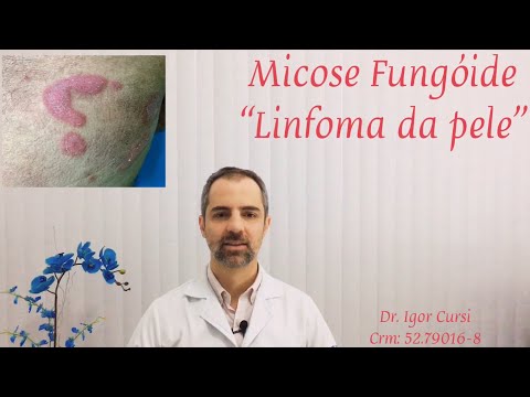 Vídeo: Câncer De Pele (linfoma Epidermotrópico) Em Cães