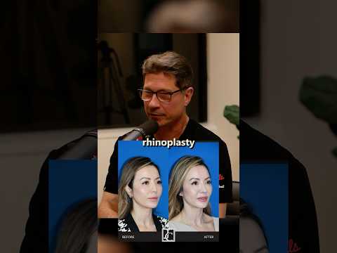 Asian Rhinoplasty #plasticsurgery #rhinoplasty #plasticandbeauty #podcast