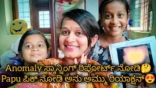 Download Lagu Anomaly ಸ್ಕಾನ್ನಿಂಗ್ ಅಲ್ಲಿ ಡಾಕ್ಟರ್ ಏನ್ ಅಂದ್ರು?😍 ಅಮ್ಮು ಅನು ರಿಯಾಕ್ಷನ್ ಹೇಗಿತ್ತು?🥰husband ಜೊತೆ ಹೋಗಿದ್ದೆ😛 MP3