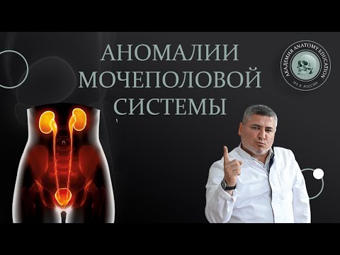 Аномалии мочеполовой системы