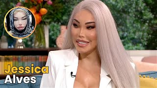 He Was a Famous Actor Before His Plastic Surgery, Guess Who | Jessica Alves
