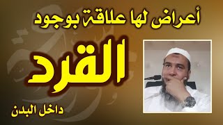 أعراض لها علاقة بوجود القرد الخنزير الهدهد الكلب في البدن وسر اختيار الساحر لهذه الأنواع من الجن