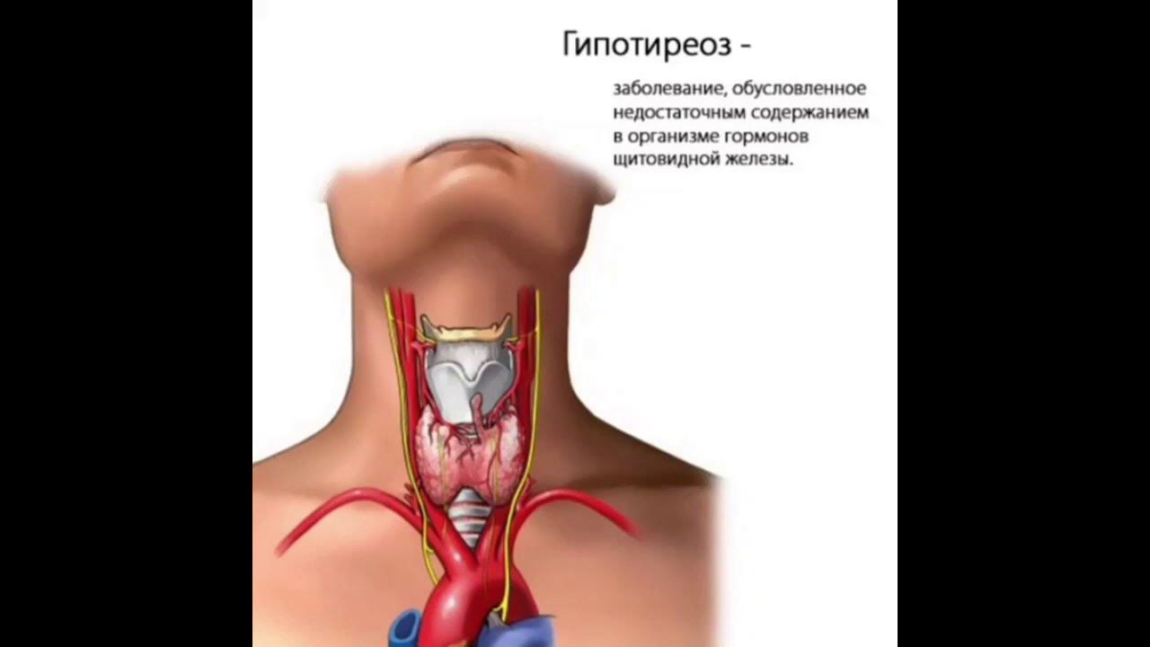 Расположение щитовидной железы у женщин картинка