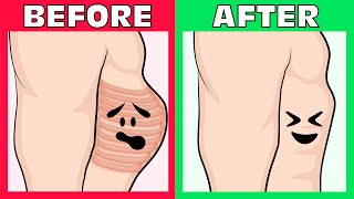 How to Fix Flared Ribs Naturally without any Equipment!