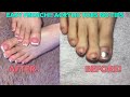 FRENCH TIP ACRYLIC TOES!| ACRYLIC TOES NO TIPS| FRENCH TIP HACK!