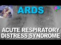 What is ards acute respiratory distress syndrome