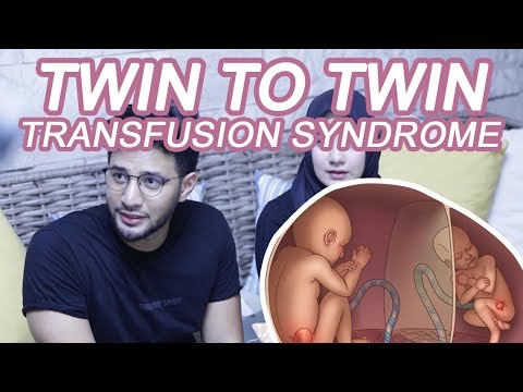 VLOG #3 : SI KEMBAR UDAH ADA TANGANNYA / GILIRAN JEJE CUEK