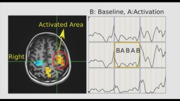 Zoom MRSI at 7T for High-resolution GABA and Glutamate Mapping (fMRSI)