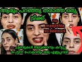 ചുണ്ടിലെ കറുപ്പ്മാറാൻ ഇത്രയുംനല്ല എളുപ്പവഴിഇനിവേറെഇല്ല remove pigmentation get smoothpinkglossy lips