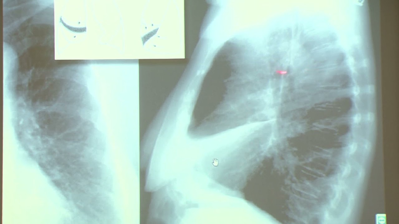تفسیر CXR دکتر مجری _قسمت نهم