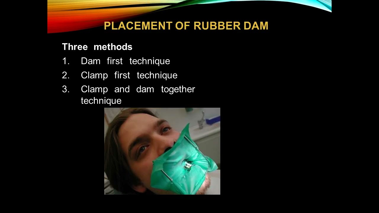 RUBBER DAM AND LOCAL ANESTHESIA