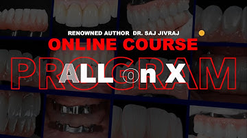 The Ultimate All on X Program - with Dr. Saj Jivraj, Digital Dental Institute