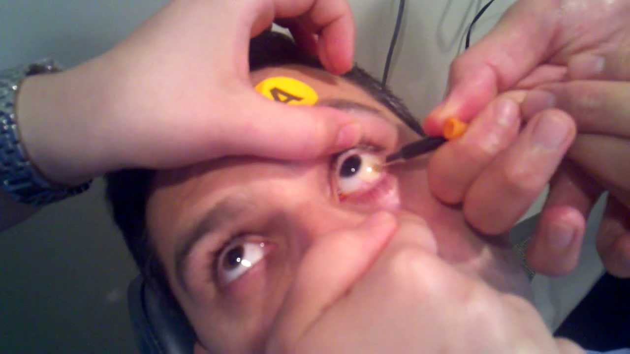 Needle in the eye YouTube