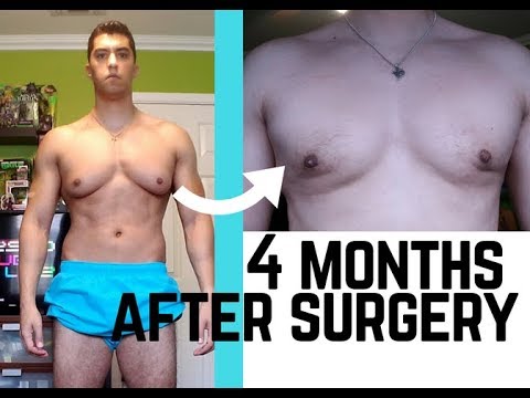 Gynecomastia Healing Side Effects What To Expect During, 53% OFF