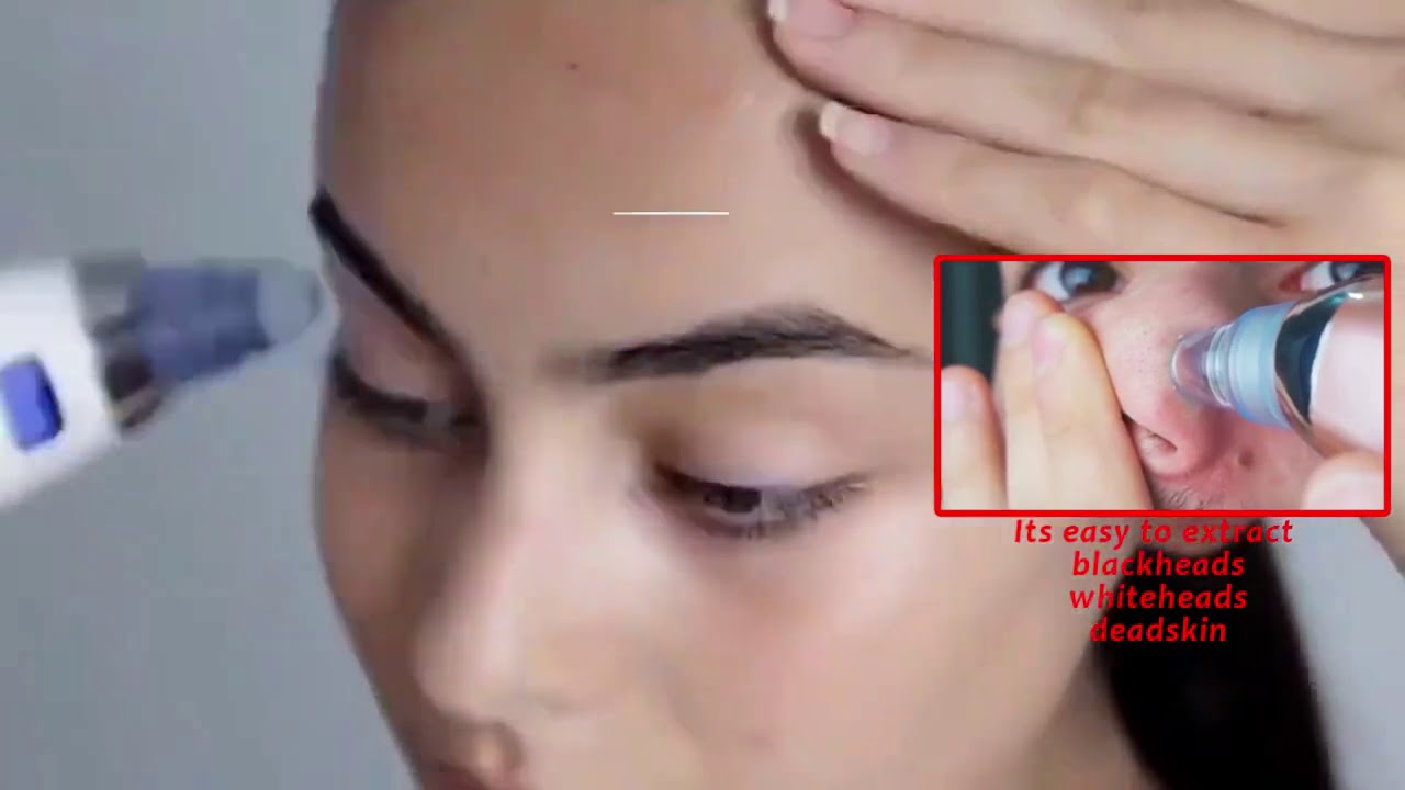 Blackhead Vacuum Electric Pore Cleaner