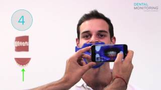 Dental Monitoring "Photo" exam tutorial with Invsalign aligners in screenshot 4