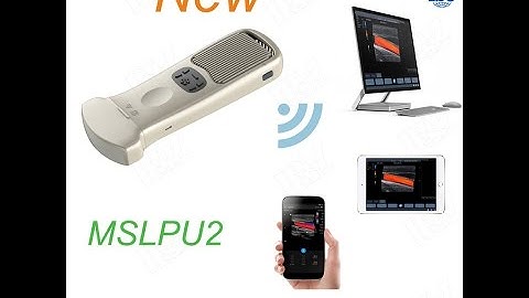 Wireless color doppler Convex probe for Android tablet