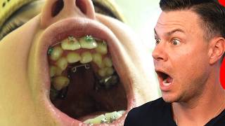 Watching Teeth Nightmares So You Don't Have To..