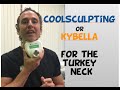 CoolSculpting or Kybella of the neck