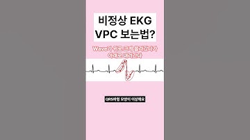 EKG VPC 볼 줄 모르니? 내일까지 알아와요