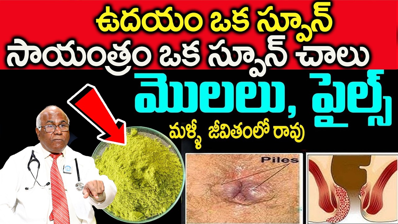 మజ్జిగలో కలిపి ఒక స్పూన్ చాలు మొలలుశాశ్వతంగా మాయం | eliminate the warts forever | Dr CL Venkata rao