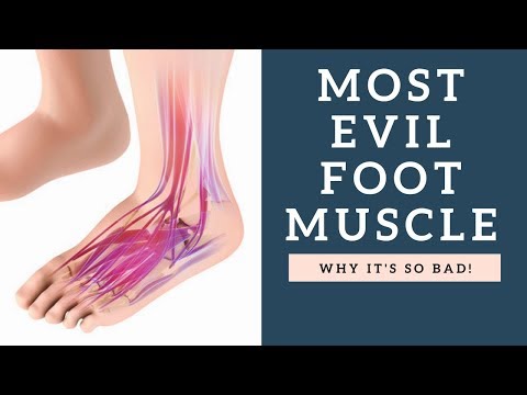 Most EVIL Foot Muscle That Causes Bunions & Foot Pain In Women And Men!