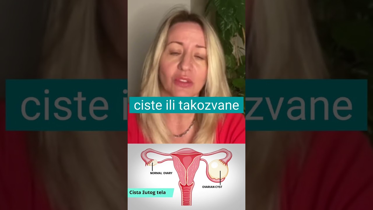 Da li možeš da zatrudnis ako imaš cistu na jajniku?