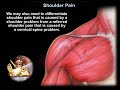 Shoulder Pain - Everything You Need To Know - Dr. Nabil Ebraheim